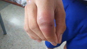 腎功能檢查項目：瞭解你的腎臟健康