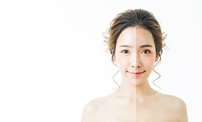 深圳哪家醫院美白效果好？美容科專家爲你解答